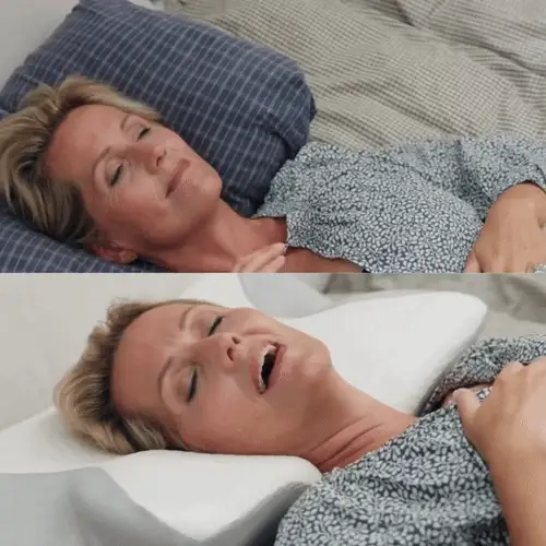 Před a po s OrthoSleep